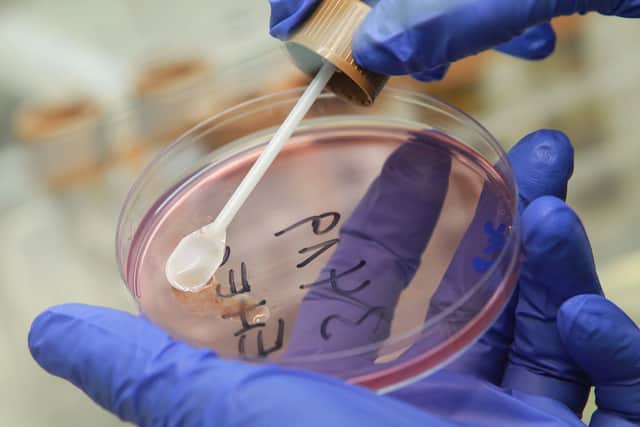 A person in the UK has died in an E.coli outbreak. (Photo: Sean Gallup/Getty Images)