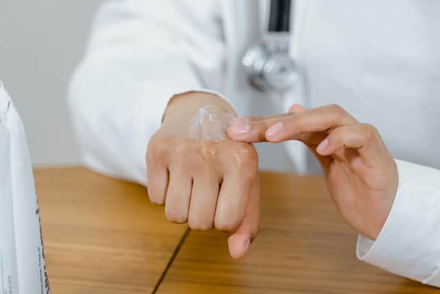 Children with this common skin condition may be more likely to suffer from hay fever later in life.