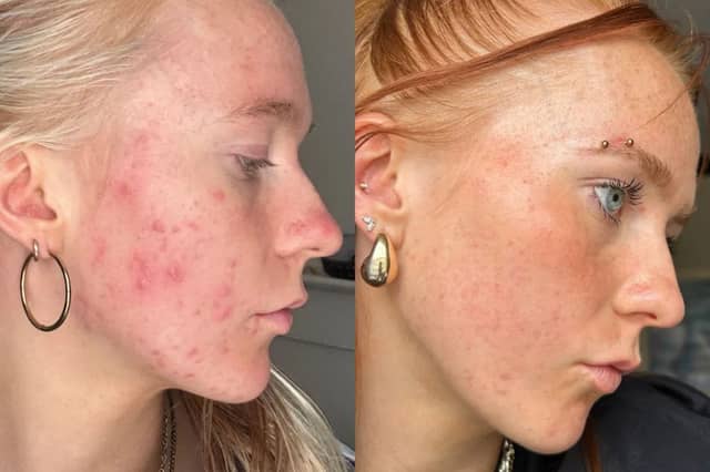 47 Skin: The dermatologist-approved routine for clearer, calmer skin this winter (aff)