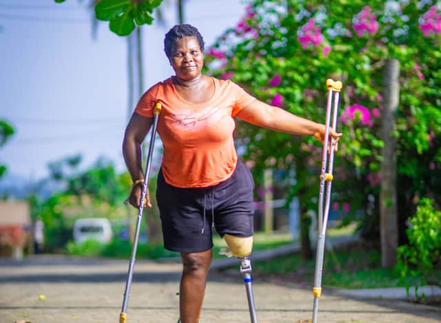 Catherine from Ghana. She lost her leg in a road traffic accident, and now has been fitted with a leg from STAND. 