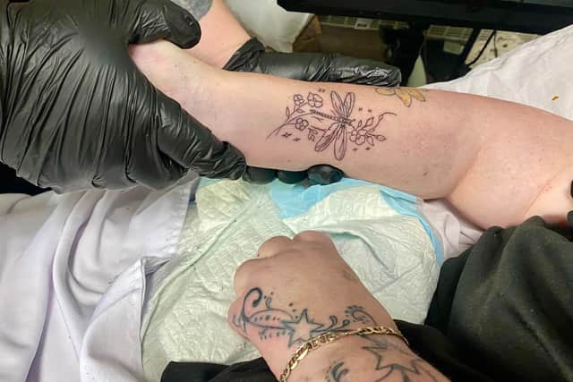 Anna was also able to have some cover up work done at the home in the comfort of her own room