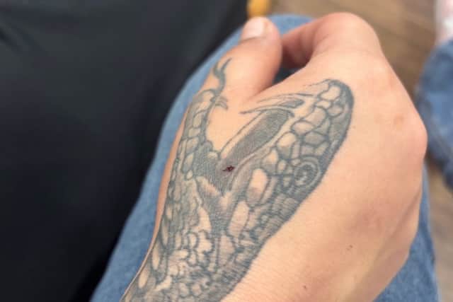 Honey's owner also sustained bites and scratches
