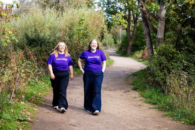 Psoriasis UK will launch its national ‘Walk and Talk’ community project with a pilot event in Northampton later this week.