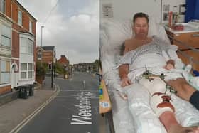 Stuart Johnson was hospitalised following a horror smash
