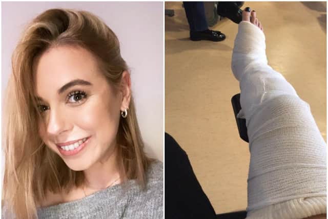 Amber Carter-Thompson suffered a broken leg in a hit-and-run on Wellingborough Road, Northampton, in April, 2019