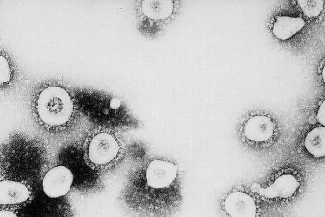 At least five cases of coronavirus have been confirmed in the UK.
