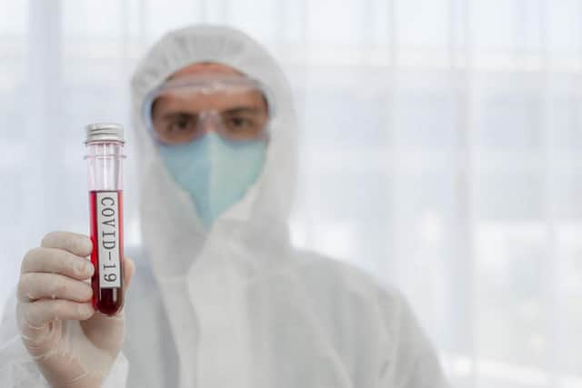 Coronavirus tests are free through the NHS.