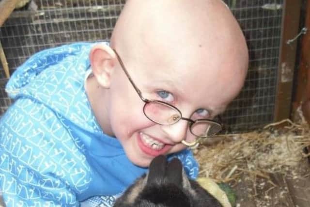 Alfe pictures during chemotherapy