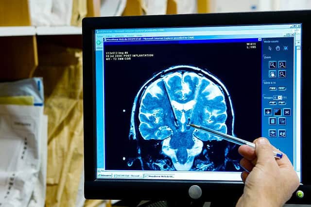 Tens of thousands of people missed out on potentially life-saving scans like MRI and CT tests across the country this year. Photo: Getty Images