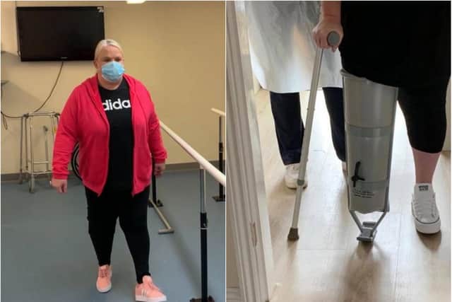Clare is walking on her prosthetic leg just 16 weeks after her amputation.