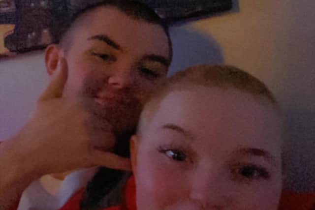 They are now getting used to living with no hair.
