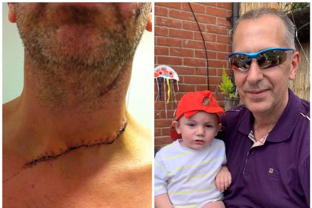 Simon Glover has seen six new grandkids since his horrific injury on Good Friday in 2013