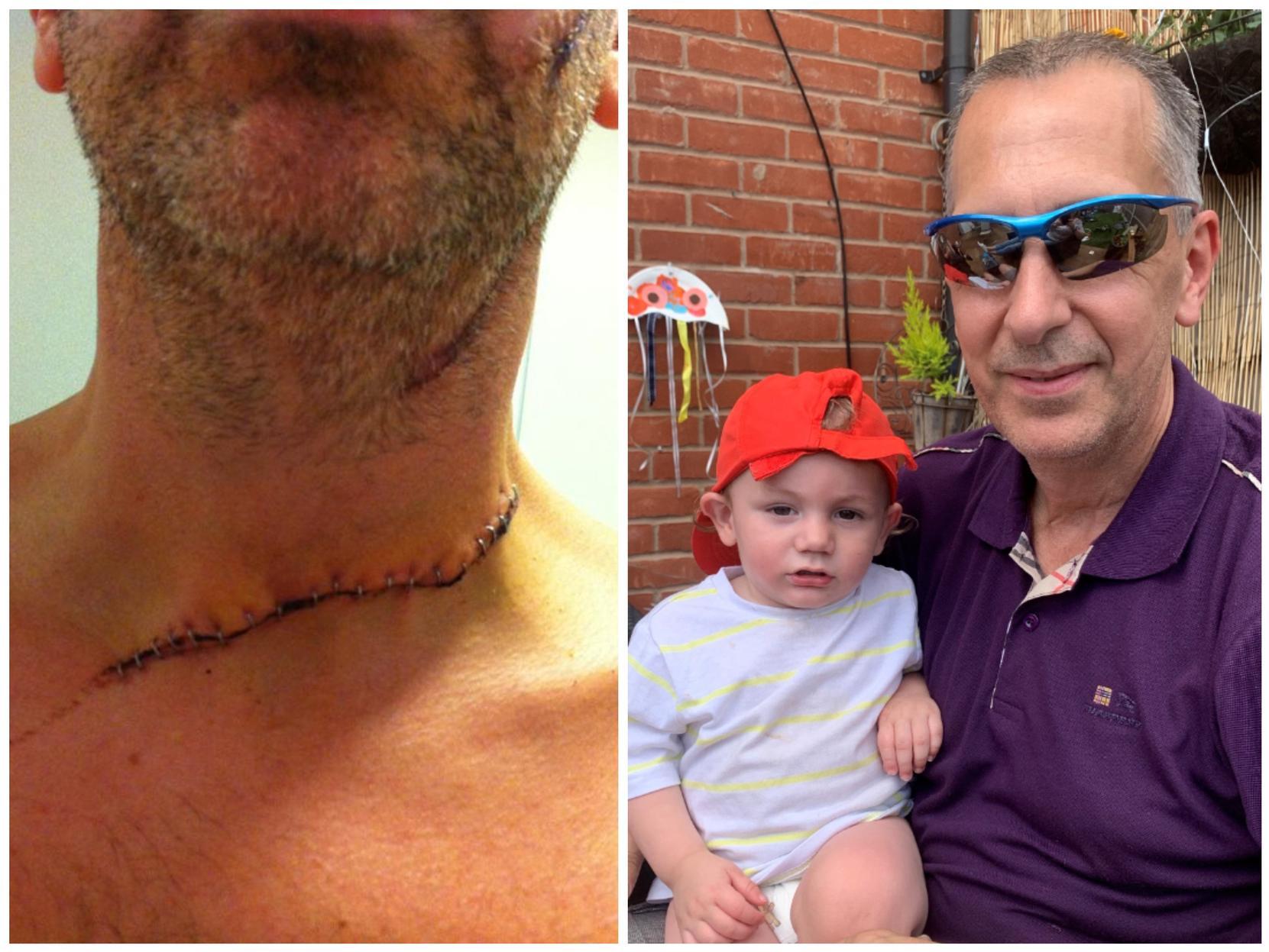 Good Friday DIY horror as power tool slashes Northampton man's throat - Vimarsana News