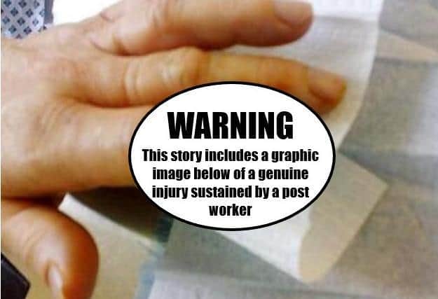 This image, uncensored further down this article, is of a genuine post worker's injury which the CWU shares to show the dangers posed by dogs to its members