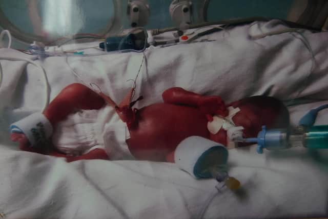 Baby Christine was born at just 25 weeks and two days old weighing one pound and 12 ounces in July this year.