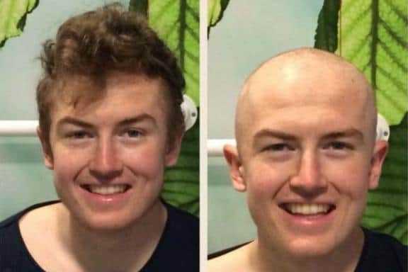 Zac Forskitt died at the age of 20.