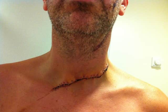 Simon Glover's throat was cut with an angle grinder in 2013 when he was doing DIY at his Northampton home.