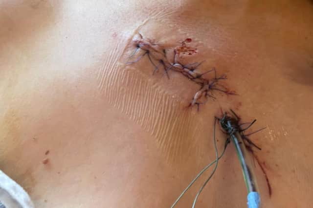 Samantha's injury.