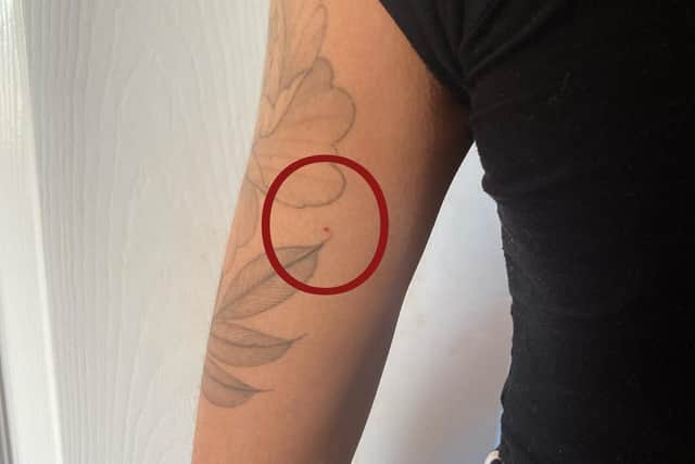 A needle mark can be seen at the back of the woman's left arm