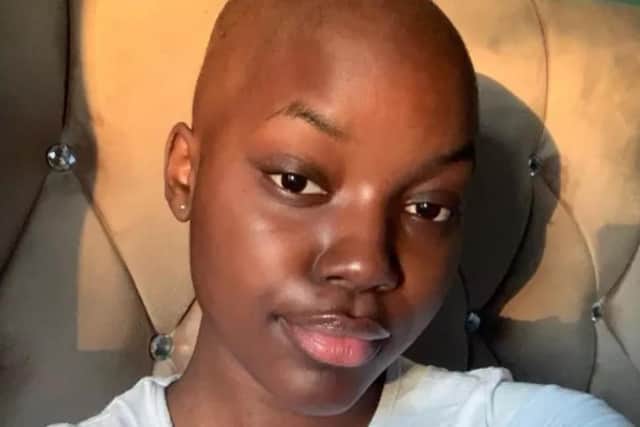 Yami Moloteni, 19, lost her hair when she started chemotherapy in September 2021.