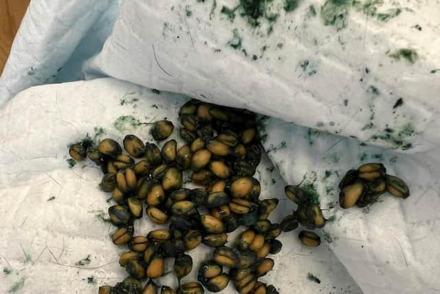 These are the pellets that were extracted from Kobe's stomach.