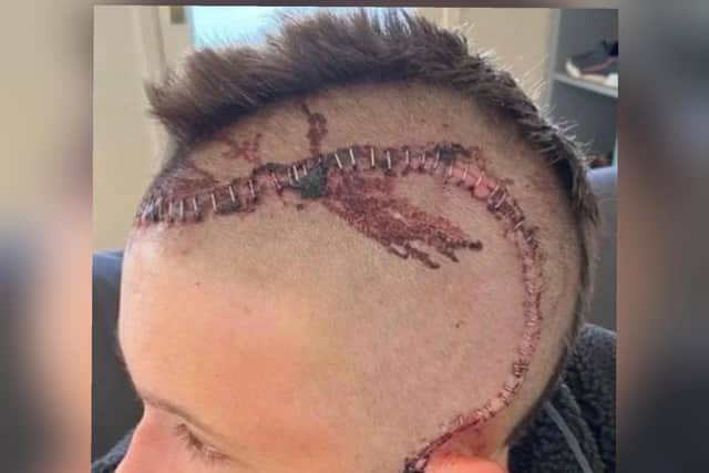 The shocking injuries PC Clarke suffered.