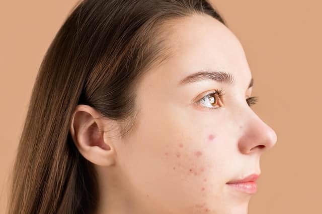 Clarins has looked at a combination of pollution, humidity, temperature, precipitation, and wind to identify the country’s best and worst skin health environments.