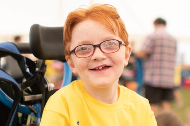 Alexanda Harvey was born with Phenylketonuria (PKU).