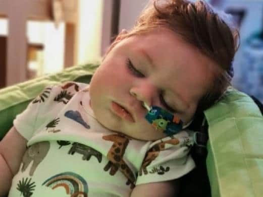 Teddy has a condition which means he has to be feed through a tube.