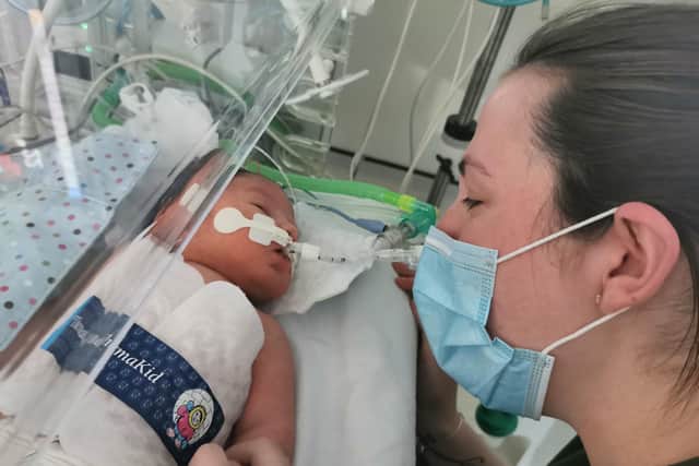 Teddy was in ICU for five weeks when he was born.