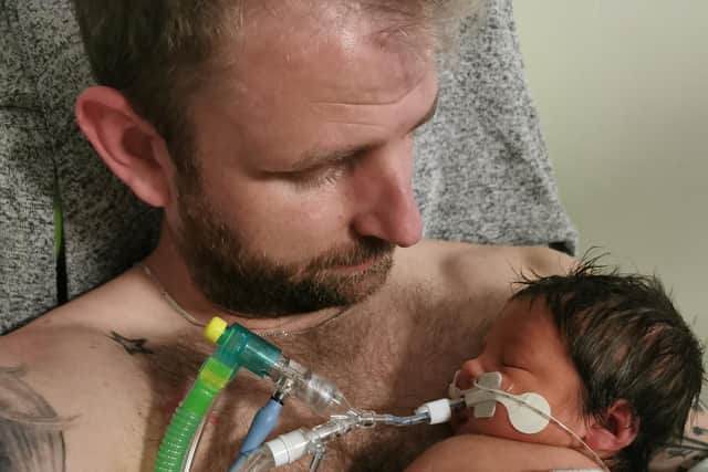 Teddy's mum and dad are hoping to raise money to give him the best care possible.