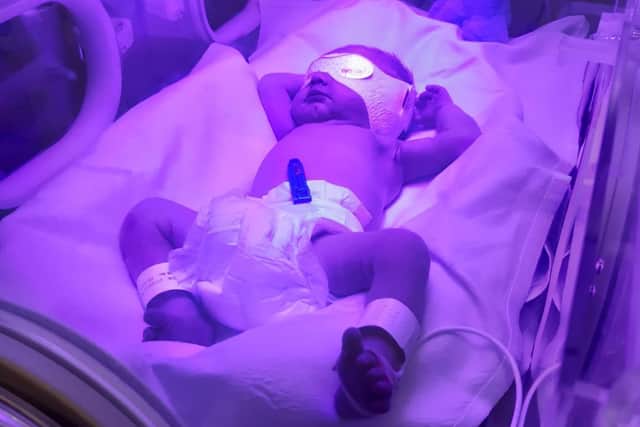 Freddie had to be put in an incubator at two-days-old due to severe jaundice.