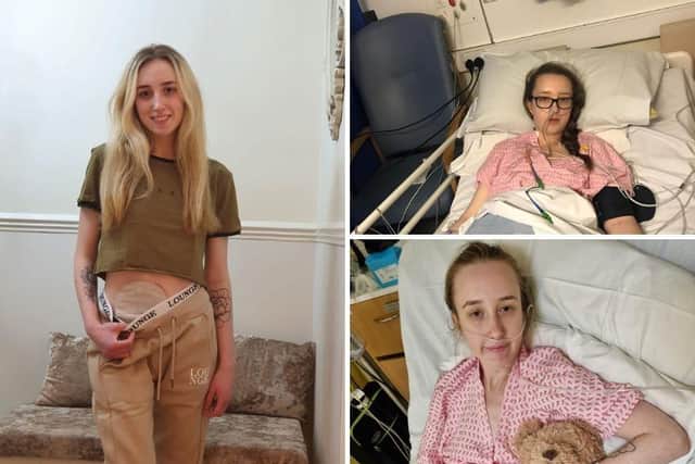 24-year-old Lauren Kelly has endured multiple invasive treatments over the past nine years, including chemotherapy, but sadly none were successful in putting her into remission.
