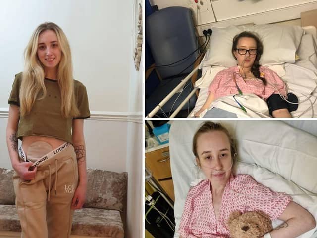 24-year-old Lauren Kelly has endured multiple invasive treatments over the past nine years, including chemotherapy, but sadly none were successful in putting her into remission.