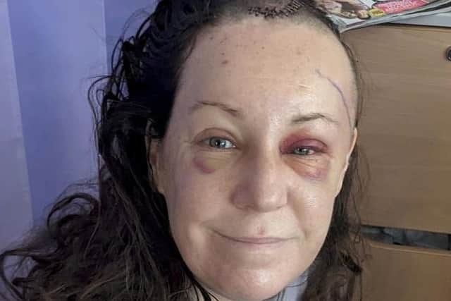 Gemma Hillier in hospital.