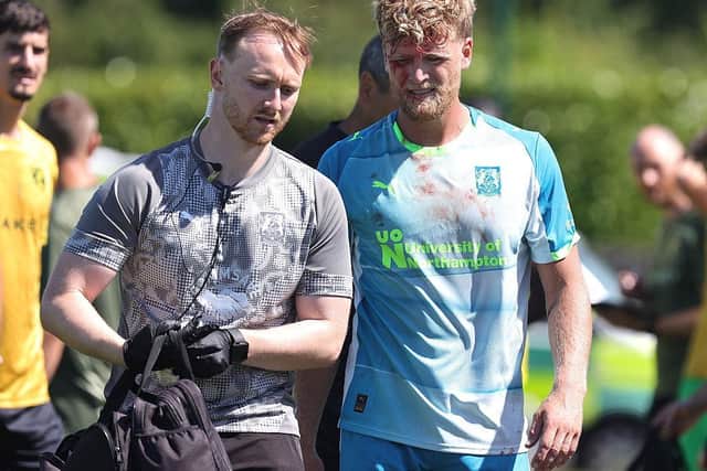 Cameron McGeehan was left with a bloody face after being caught by Brad Hills