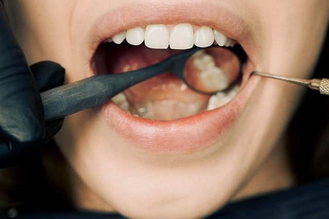 Oral self-checks can help save lives - that's the message during Mouth Cancer Action Month