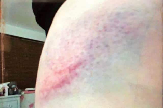 Jessica started taking photographs of her injuries because she feared she would be killed in her own home.