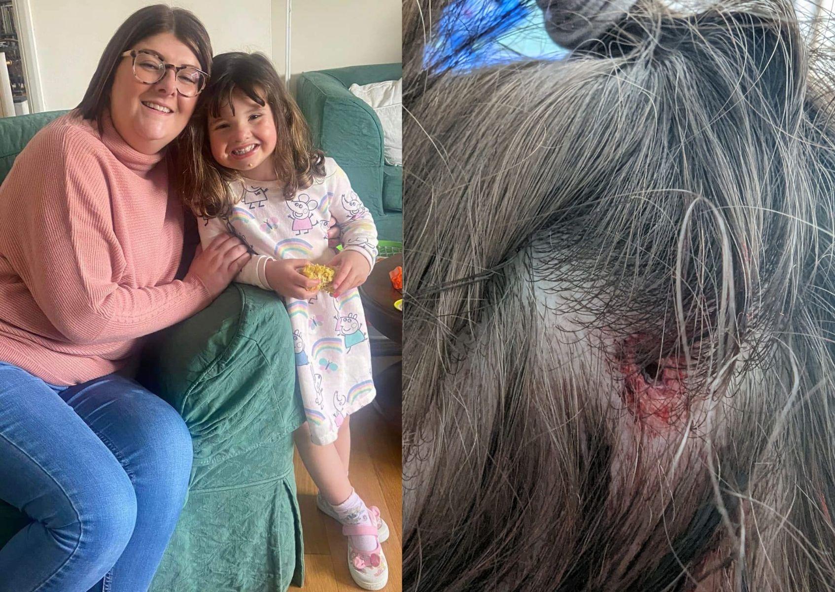 Mum's anger after daughter suffers head wound in Kettering soft play 'nightmare' - Vimarsana News