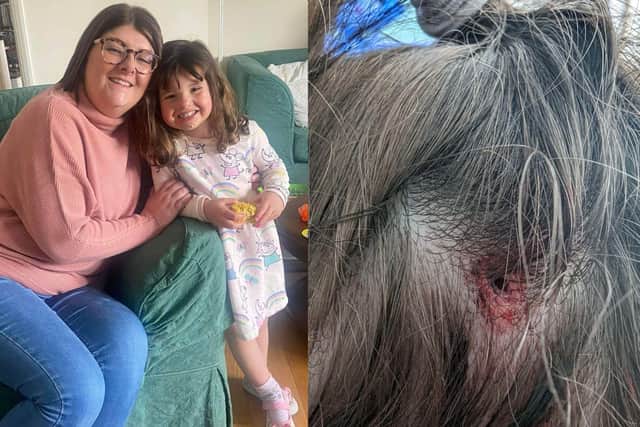 Nicole Bates with her daughter Emilie and, right, the head wound Emilie suffered