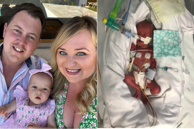 Parents, Katrina and Lewis Whitham with their baby, Elsie, and Elsie when she was just 27 weeks old born premature.