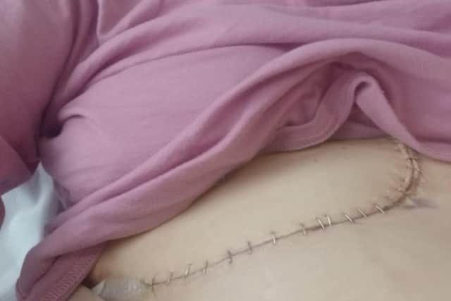 Gemma has had three transplants and is no finally happy and healthy 