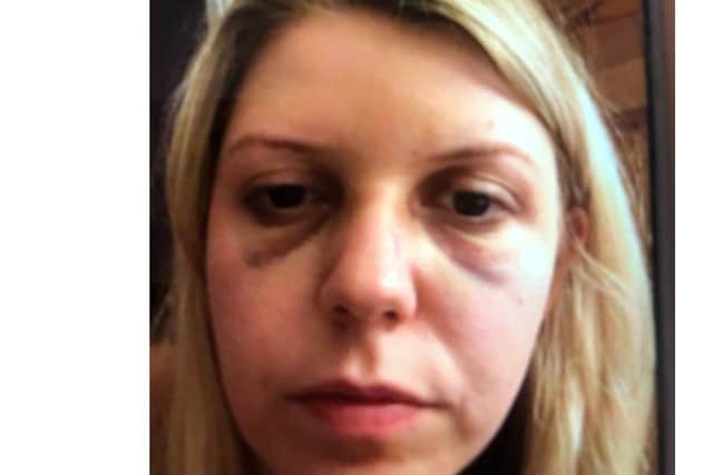 Jessica's would often turn up to work with black eyes and bruises.