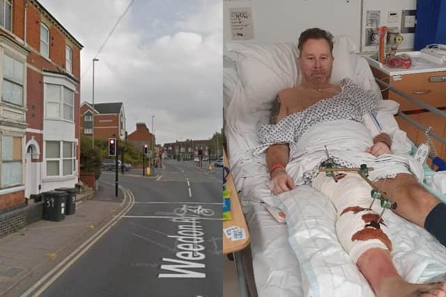 Man who broke his leg after being knocked off e-scooter backs campaign ...