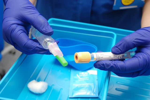 Blood borne virus testing is launching at NGH's emergency department.