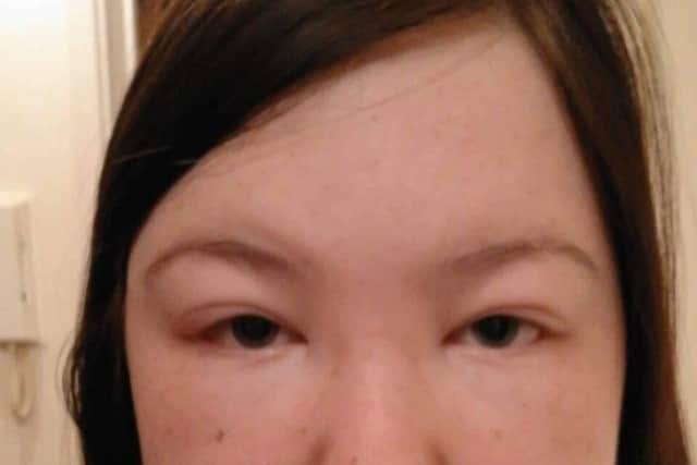Helen when her face was swollen
