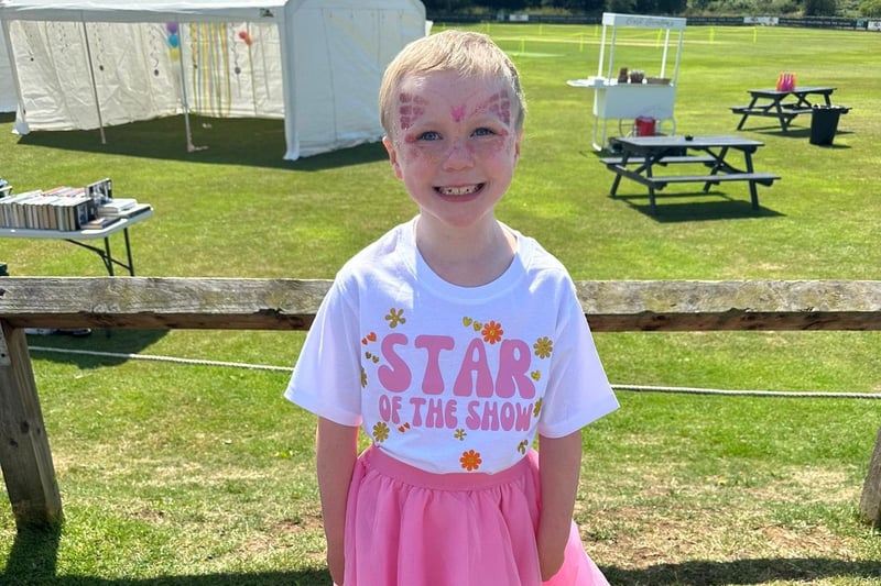 With more than £5,000 raised for Alopecia UK, this will allow them to work towards finding new treatments, medications and answers for the families affected.