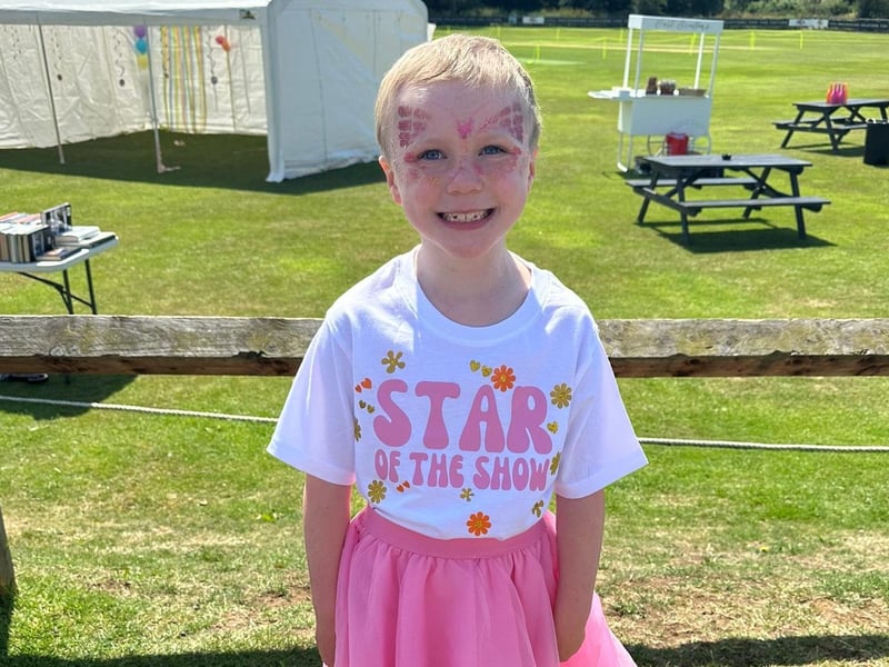 With more than £5,000 raised for Alopecia UK, this will allow them to work towards finding new treatments, medications and answers for the families affected.