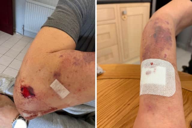 Due to the lack of light along the stretch, Brian became disoriented in the pitch black. He lost hold of the fence and walked straight over the side of the embankment, falling 20 or so feet to the bottom.