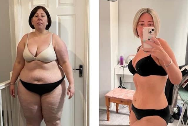 Aimee Coles before and after her eight stone weight loss.
